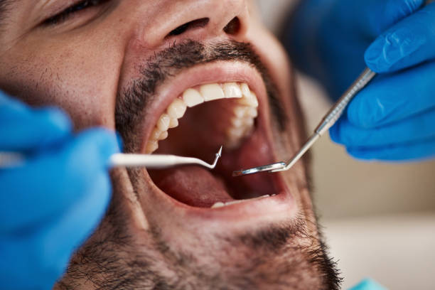 Best Emergency Denture Repair in North Tustin, CA